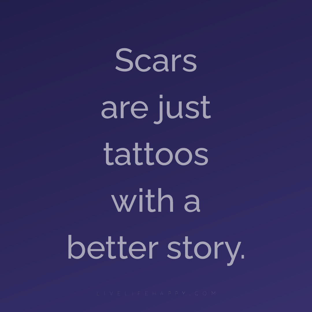 Scars are just tattoos with a better story. — Author Unknown