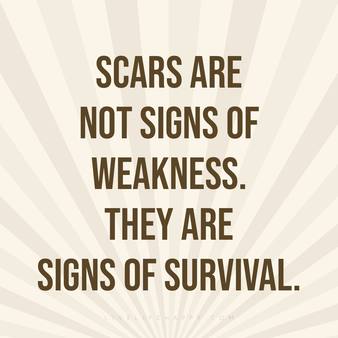 Scars are not signs of weakness. They are signs of s... — Author Unknown