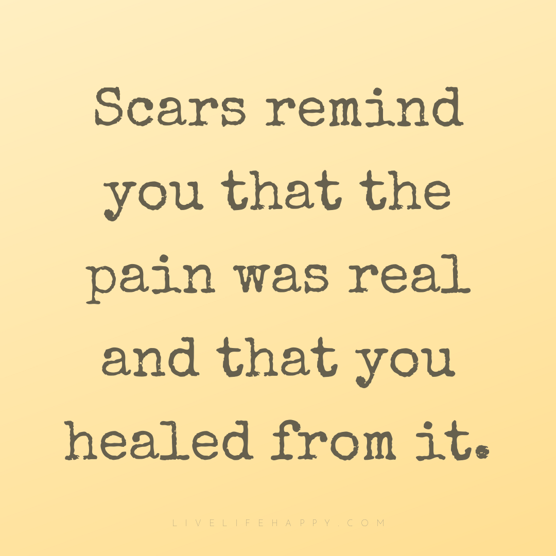 Scars remind you that the pain was real and that you... — Author Unknown