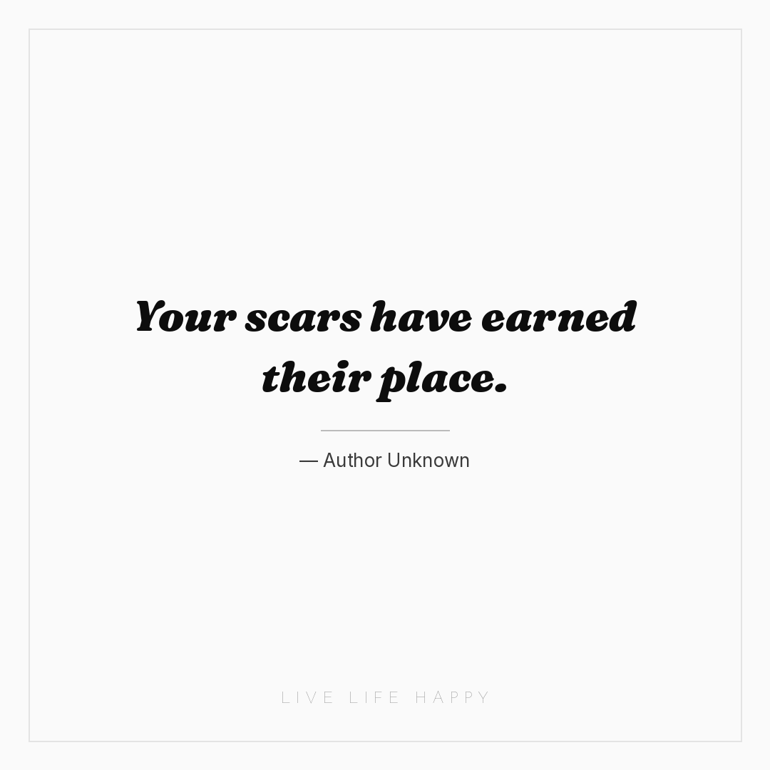 Your scars have earned their place. — Author Unknown